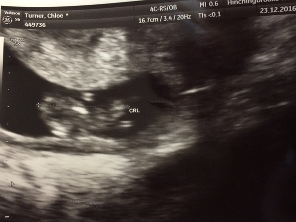 9 weeks and red blood.