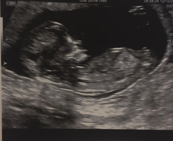 Due in June, 12 week scans happening and coming up!