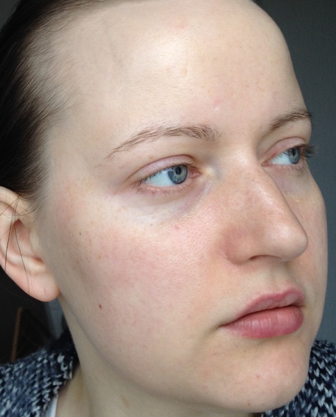 Is anyone brave/confident enough to post a pic of their skin without any make up??