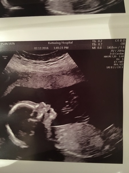 April 2017 #5 - second trimester! Less feeling crap, more feeling kicks