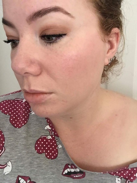 Is anyone brave/confident enough to post a pic of their skin without any make up??