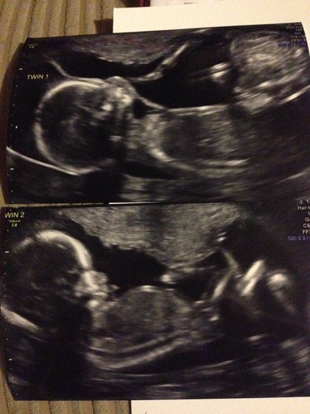 Due in June, 12 week scans happening and coming up!