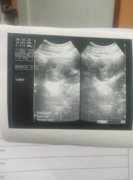 Size at 7.5 week scan - longshot query!