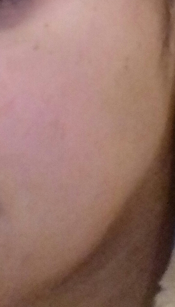 Is anyone brave/confident enough to post a pic of their skin without any make up??