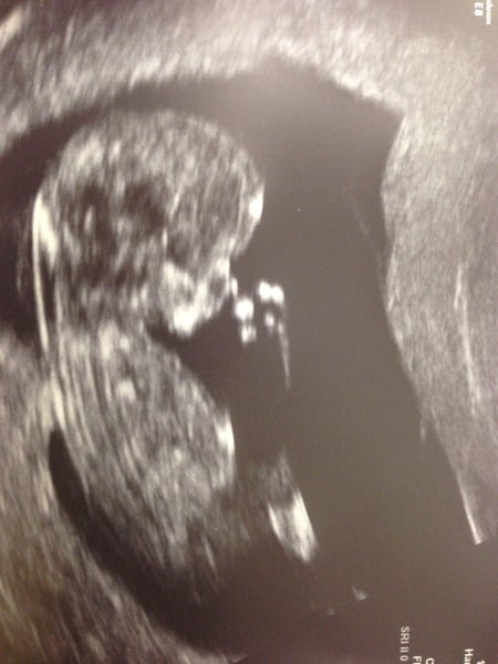 Due in June, 12 week scans happening and coming up!