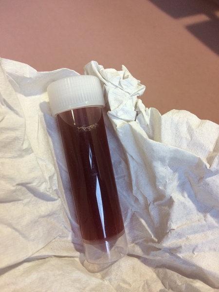 Would you go to A and E with this? (picture included)