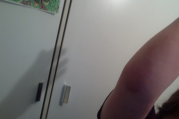 Don't know whether to get get this checked out need advice? RE joint swelling