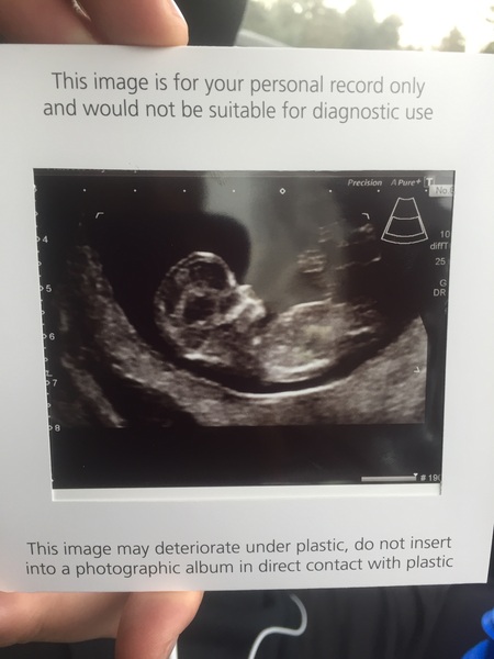 Due in June, 12 week scans happening and coming up!