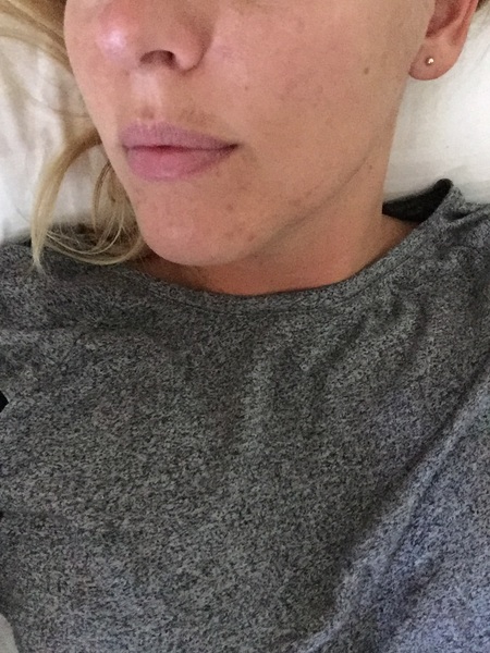Is anyone brave/confident enough to post a pic of their skin without any make up??