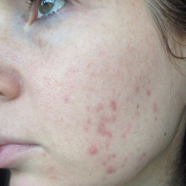 Fantastic Skincare And Where To Find It