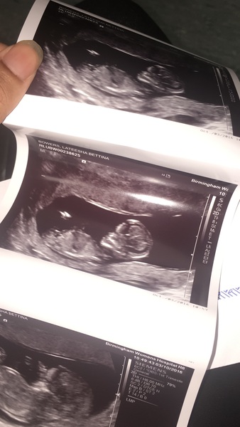 Gender guesses? I find out what my little baby is tomorrow!!