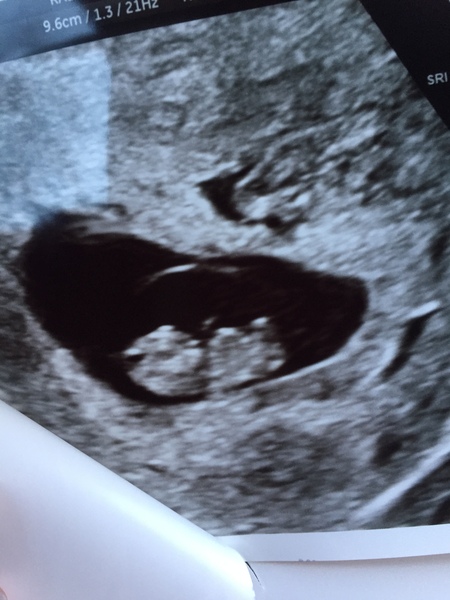 August 2017: the one in which we'll get midwife appointment