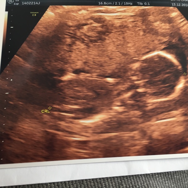 Pregnant and breastfeeding? Come and chat!