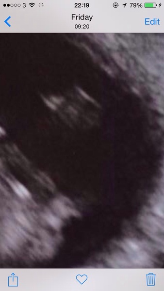 Due in June, 12 week scans happening and coming up!