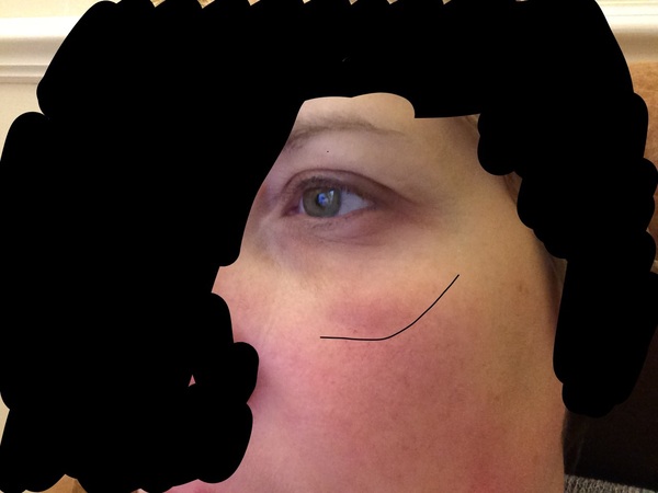 Sore eye, now swelling. Can I treat it myself? Pic inc.