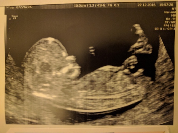 Come hither upduffed viroids here we will hold your hand through scans, rejoice at your hairy shins and of course share your lust over Ian McShane. It's JS Grads 48!