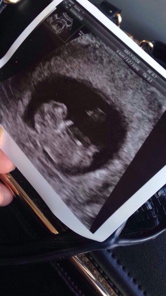 Due in June, 12 week scans happening and coming up!