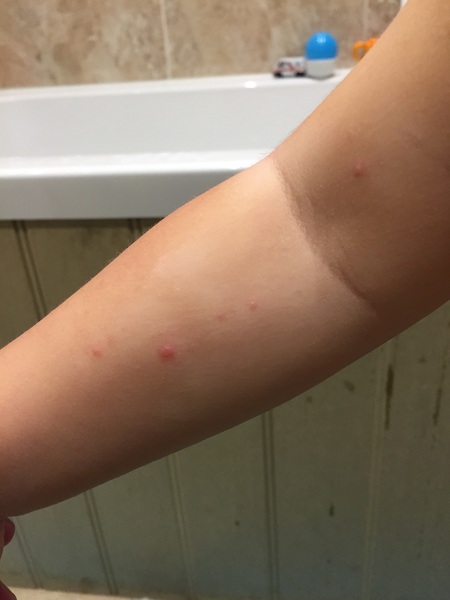 Any idea what these spots are?