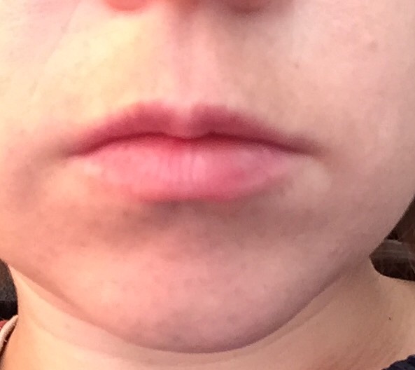 To ask how you deal with unwanted facial hair?
