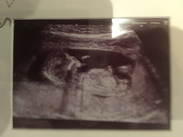 Another guess the gender! Didnt think I wanted to find out but have changed my mind ...