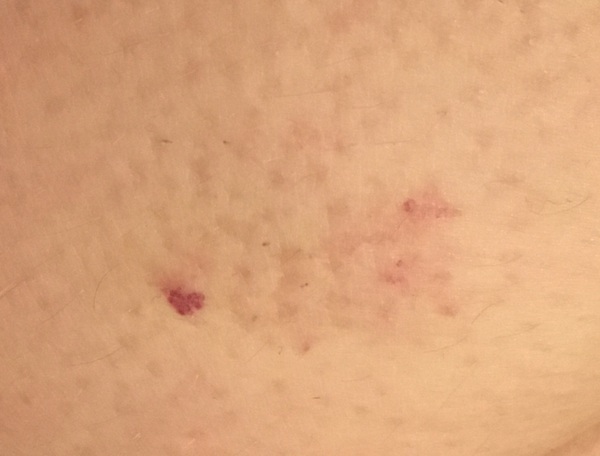What is this on my leg?