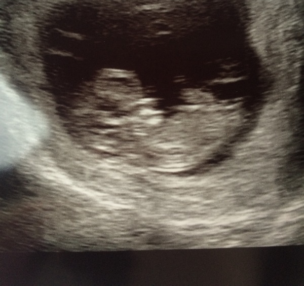 Can you actually tell from scan pic?