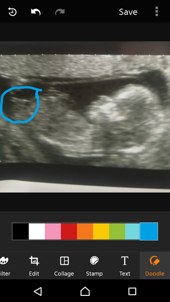 Can you actually tell from scan pic?