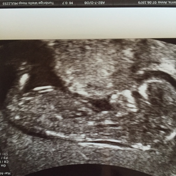 Staying posifrickentive- Thread 13 for ladies pg after mc