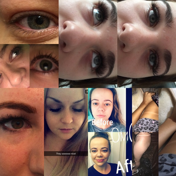 Beauty Treatments