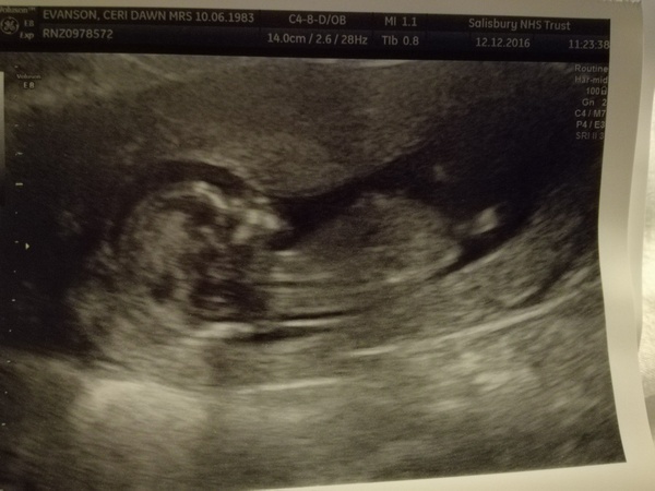 Due in June, 12 week scans happening and coming up!