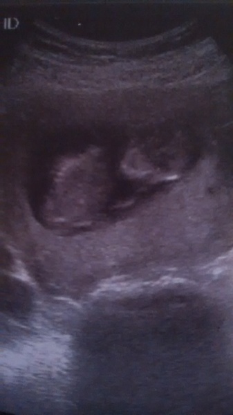 Due in June, 12 week scans happening and coming up!