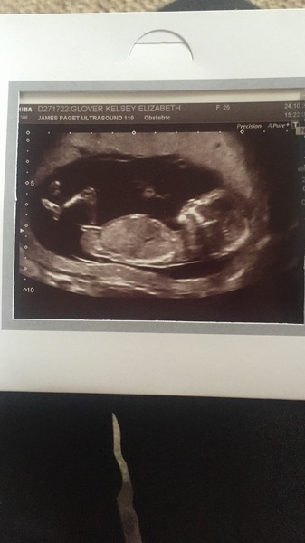 Boy or Girl?