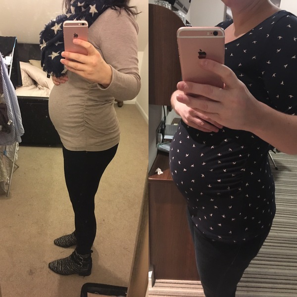 May 2017 #5 - 20 week scans and pram buying plans