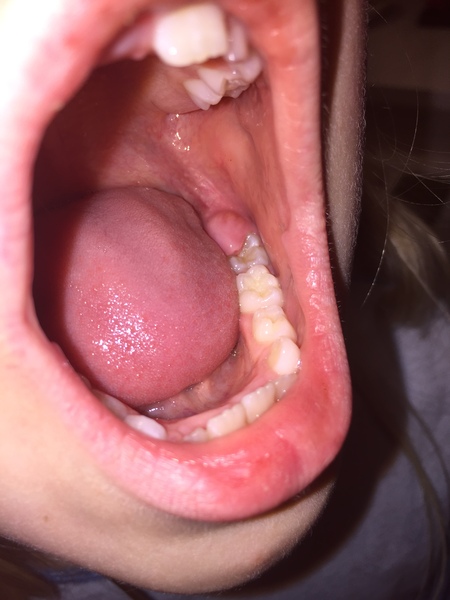 Any dentists around please?