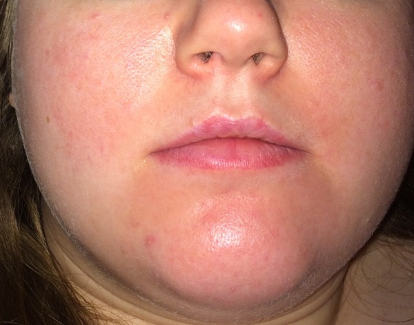 Is anyone brave/confident enough to post a pic of their skin without any make up??
