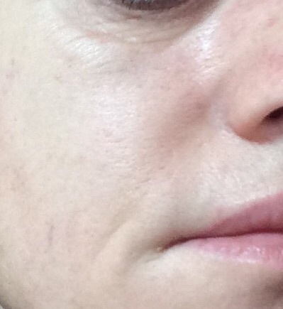 Is anyone brave/confident enough to post a pic of their skin without any make up??