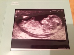 Scan photo-does this look boy or girly nub?