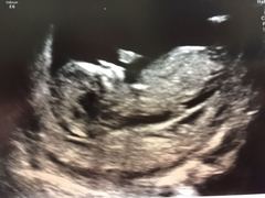 Due in June, 12 week scans happening and coming up!