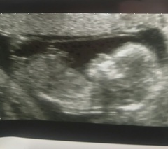 12 week scan, gender guesses?