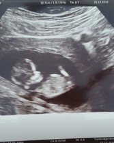 Nub Theorists out there. Girl or boy?