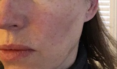 Is anyone brave/confident enough to post a pic of their skin without any make up??
