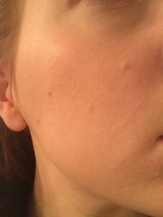 Is anyone brave/confident enough to post a pic of their skin without any make up??