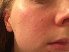 Is anyone brave/confident enough to post a pic of their skin without any make up??