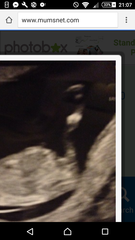 12 week scan, gender guesses?