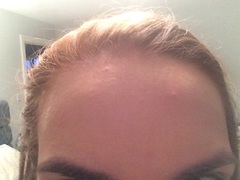 Is anyone brave/confident enough to post a pic of their skin without any make up??