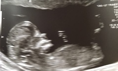 What sex do you think baby is?