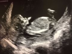 Due in June, 12 week scans happening and coming up!