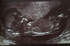 Another guess ifs its a boy/girl post