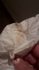 TMI Warning! is this pre-af or possible IB?