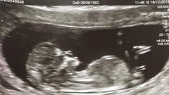 What sex do you think baby is?